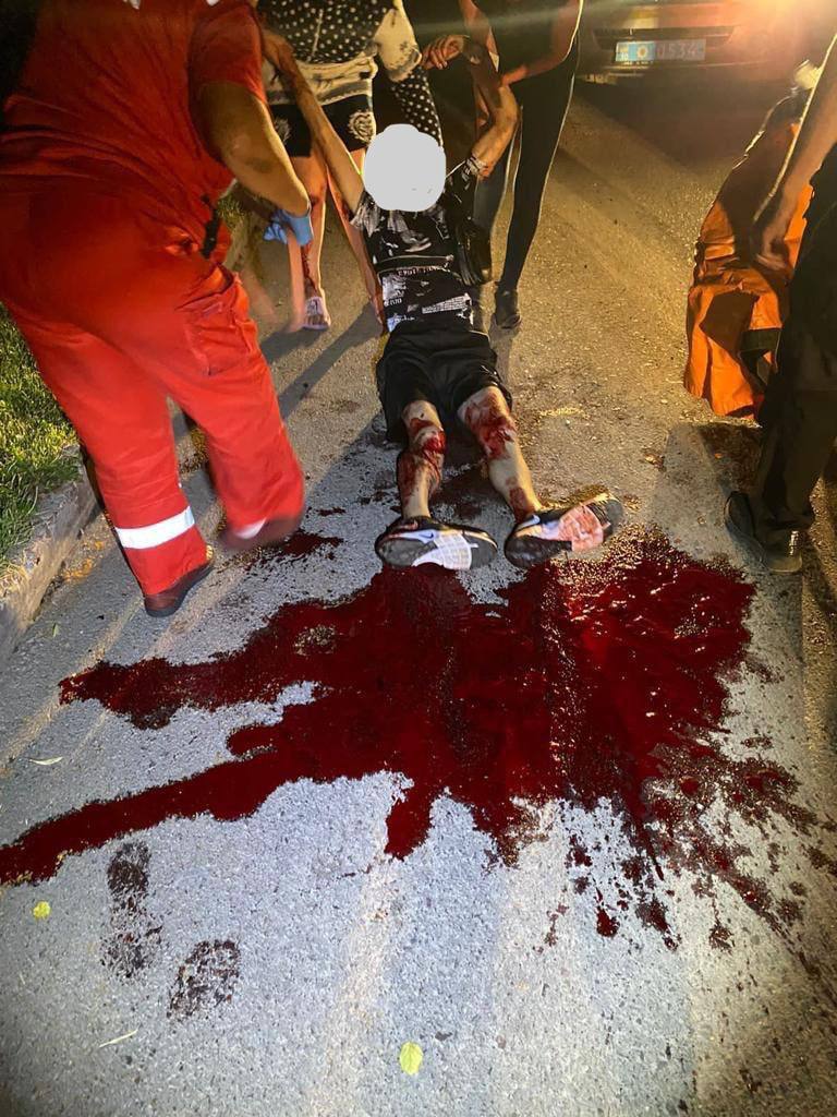 В Броварах нарушителю комендантского часа прострелили ноги, сообщают местные паблики со ссылкой на источники в полиции