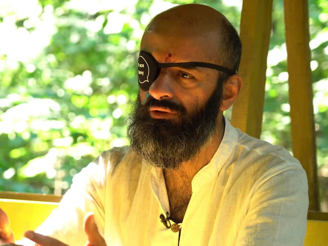 Маси Найем после ранения